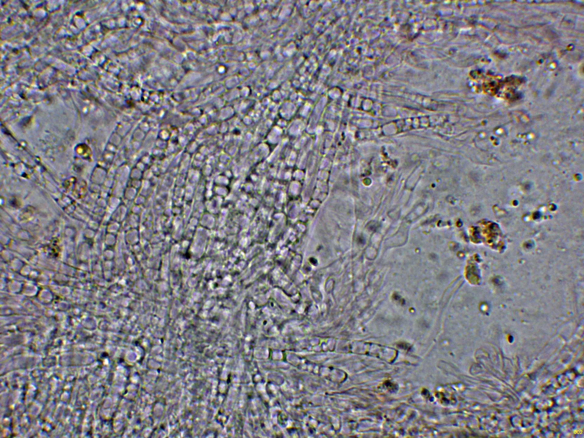 Microscopía de Ramaria praecox - 5 - Hifas tramales-002